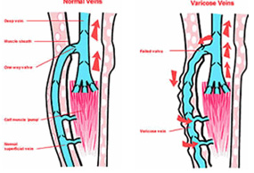 Westchester Vascular Surgery