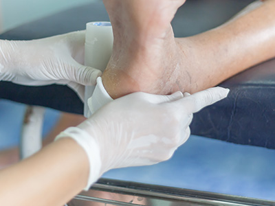 Diabetic Wound Treatment in Westchester