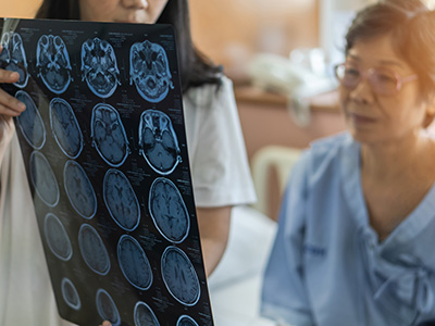 Westchester Stroke Doctor